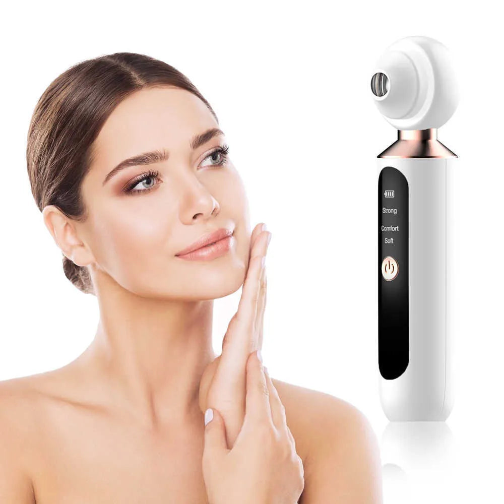 ʀᴀʀᴇ ᴡᴀʀᴇꜱ™ Blackhead Suction Machine